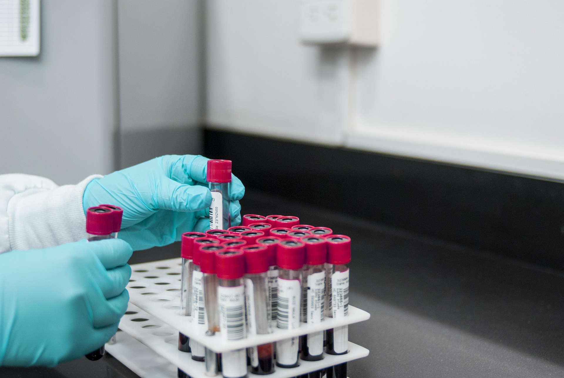 dr bright mhlongo blood sample vacutainers